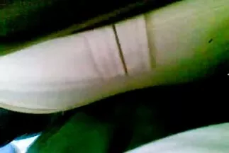 Thing: Scrotal công gai nhat ban tu suong việc.